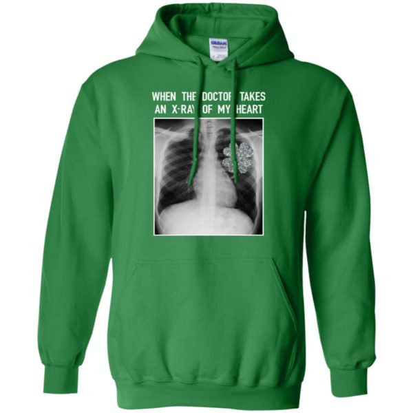 When The Doctor Takes An X ray Of My Heart Patrick Day Shirt
